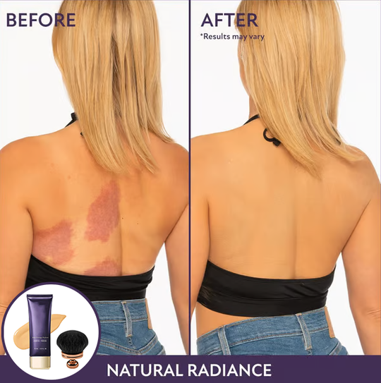 💜Last Day-Buy 1 Get 1 Free!💜✨Body Coverage Perfector – Waterproof, Lightweight & Flawless Body Makeup