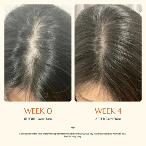 Hair GrowthSerumwith Built in Brush for Hair Growth & Thickening
