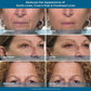 🔥 Rapid Reduction Eye Serum – Instant Tightening & Anti-Aging for Eyes & Face ✨
