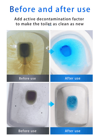 🔥Hot Sale🔥Sink and Drain Cleaner