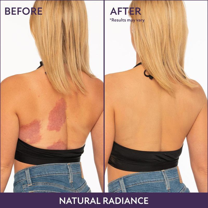 💜Last Day-Buy 1 Get 1 Free!💜✨Body Coverage Perfector – Waterproof, Lightweight & Flawless Body Makeup