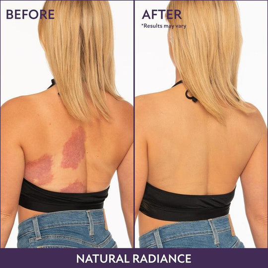 💜Last Day-Buy 1 Get 1 Free!💜✨Body Coverage Perfector – Waterproof, Lightweight & Flawless Body Makeup