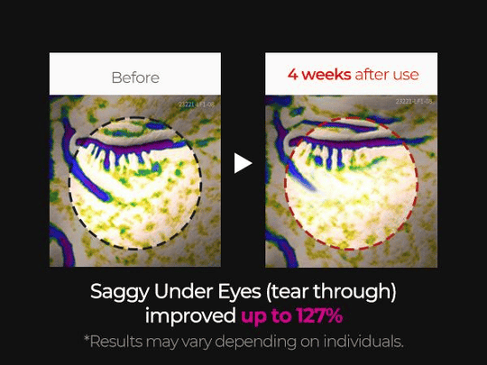 Gifted Collagen Boost Set Pore Spot Skin Care Calcium Collagen Volume Firming Balm for Enhanced Skin Health routine