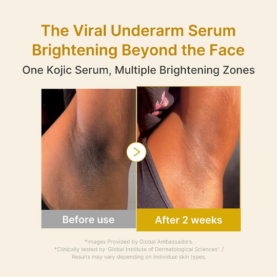 Kojic Acid Turmeric Power Duo for Face & body | Ideal for Troubled Skin & Use After Spot Care | Soothing & Calming with Kojic Acid, Turmeric, Niacinamide