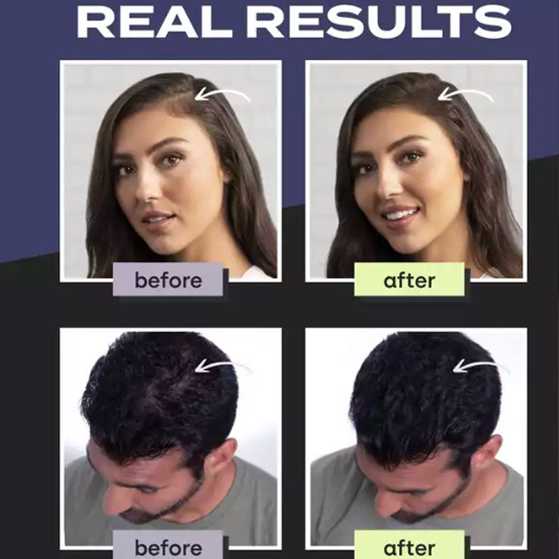 Hair Building Fibers Set for Thinning Hair & Bald Spots