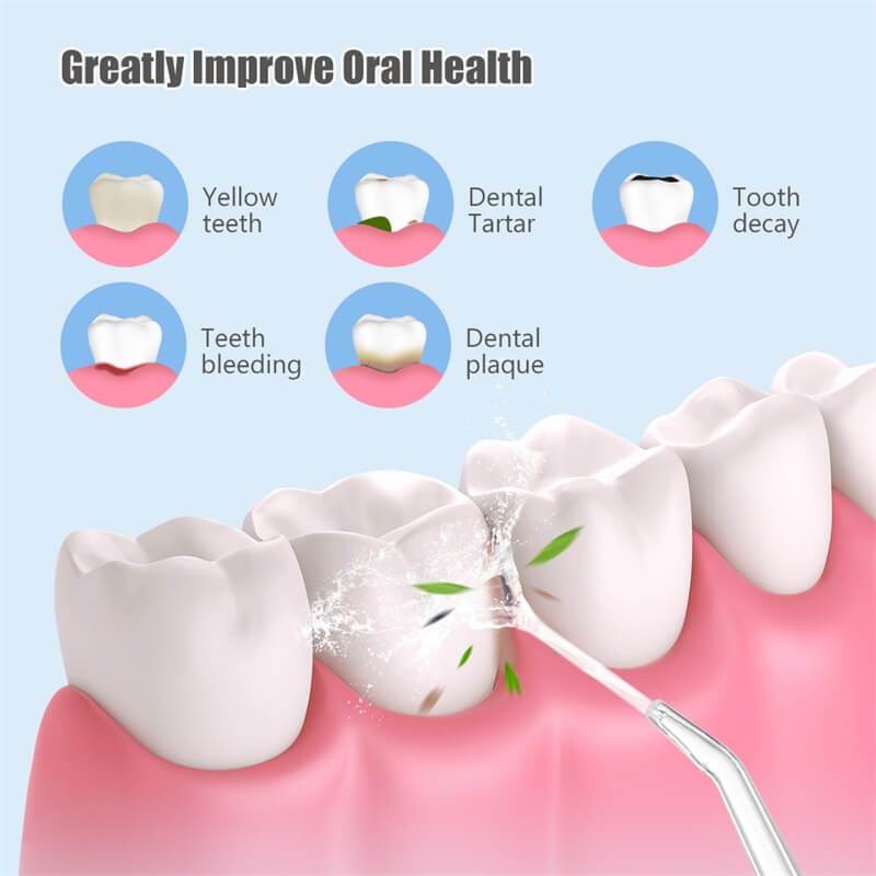 Portable Oral Irrigator Water Flosser (Original)