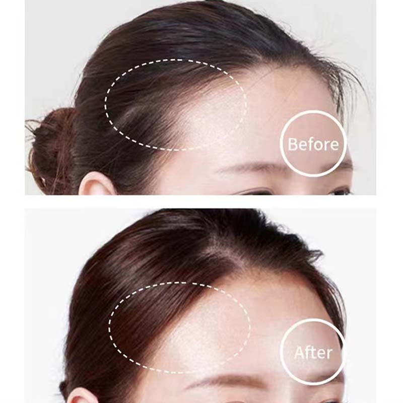Portable Hairline Power Stick