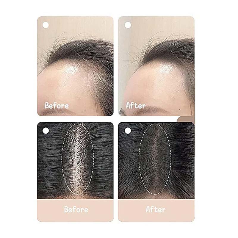 Portable Hairline Power Stick