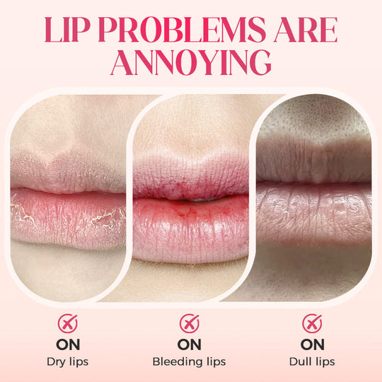 ⏳2026 NEW YEAR💥BUY 1 GET 1 FREE⚡50K+ SOLD!✨Nooni Apple Hydrating Moisturizer Plump Transfer-proof Glossy Lip Stain Oil💋