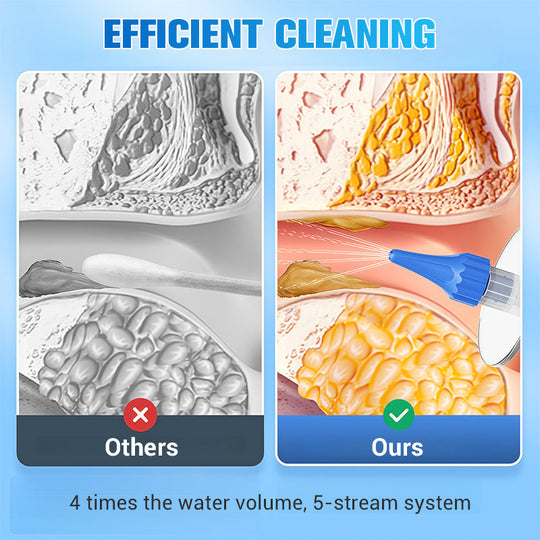 👂 HOT SALE! ⚡ Ear Wax Removal Kit – Safe & Gentle, Reusable Silicone Spoon, Easy to Use, Effective & Hygienic for Ear Cleaning ✨