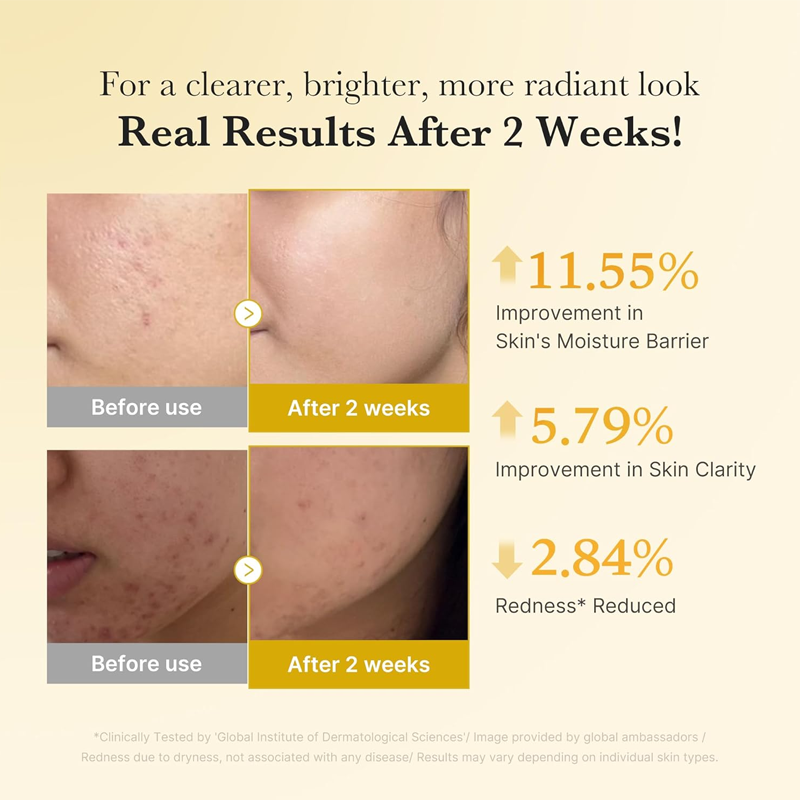 Kojic Acid Turmeric Brightening Serum